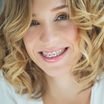 Verrett Dental Center | Dental Fillings, Dentures and All-on-6 reg